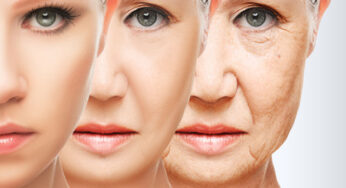 Deri Kırışıklıklarında Dermatolojik Çözümler