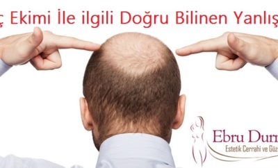 Sinameki Otu ile Saç Uzatma Kürü - En Etkili Saç Uzatma Yöntemi  