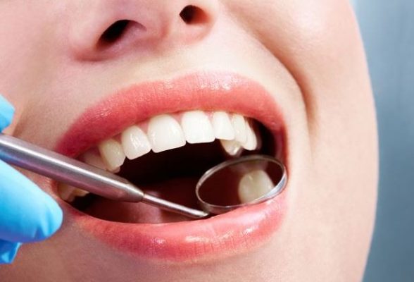 Evde Doğal Yöntemlerle Diş Bakımı ve Diş Temizliği