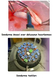 KANSER TEDAVİSİNİN ÜREME SAĞLIĞINA VERDİĞİ OLUMSUZ ETKİLER  