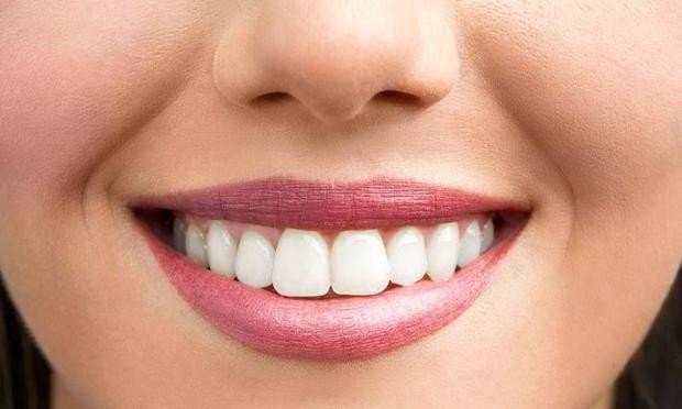 Daha Beyaz Dişler Pratik Bilgiler